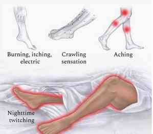 Scientists find treatment for restless leg syndrome