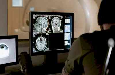 Diagnosing brain tumours early is important for better outcomes: Experts