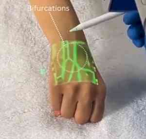 Anand Mahindra shares video of new tech detecting veins using infrared light