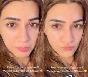 Kriti Sanon shares pictures of eyes post crying scene, needs 10 hours of sleep