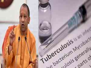 Retired IAS, IPS officers and ex VCs unite as 'Nikshay Mitras' to champion TB-free Uttar Pradesh